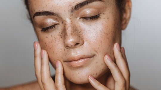 Spring Skin Problems and How to Manage Them